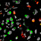 Microscopic image showing cell death of the human neural progenitor cells. The Zika virus is shown in green, the brain cells in grey, and the breached brain cells in red. Credit: Sarah C. Ogden.